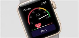 نکات و ترفندهایی برای صاحبان  (1) Apple Watches series